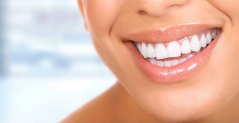 Diş Beyazlatma Yöntemleri, Diş Beyazlatma Nedir? Diş Beyazlatma Fiyatları