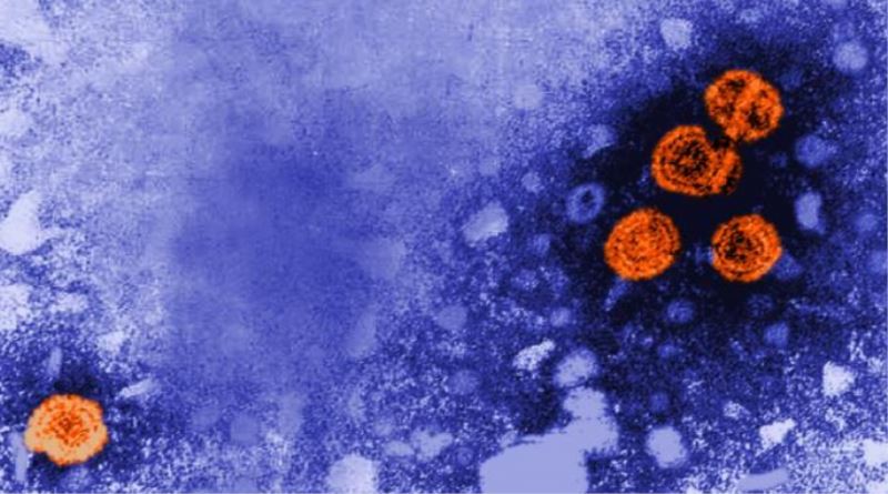 Gizemli Hepatit Virüsünde Can Kaybı 650